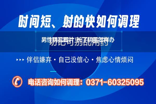 男性阴虱图片_长了阴虱怎样办